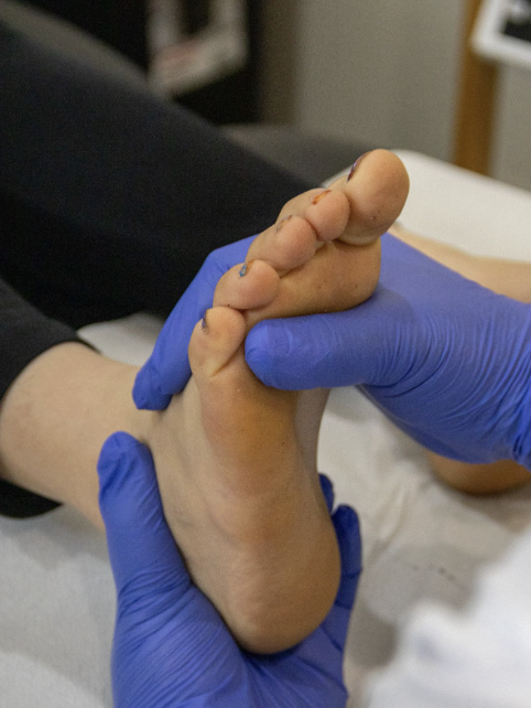 Treatment Options and Prevention Tips for Foot Wound and Ulcerations